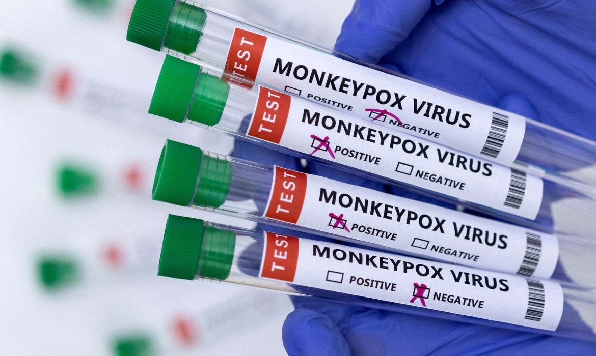 Testes - Variola dos macacos - Monkeypox