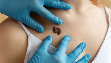 Verão: aumenta o alerta para a prevenção contra o câncer de pele