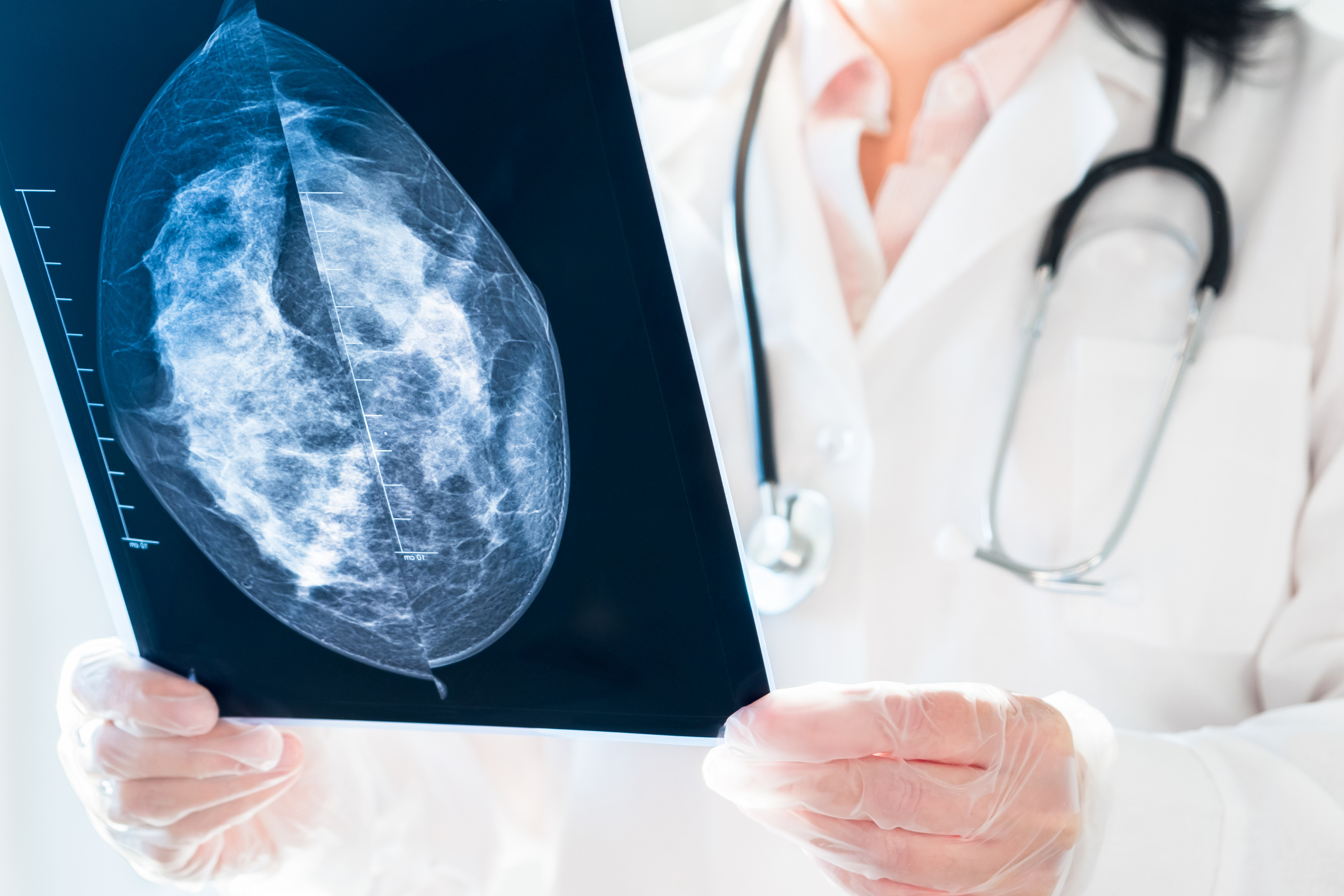 exame de mamografia - contra o câncer de mama