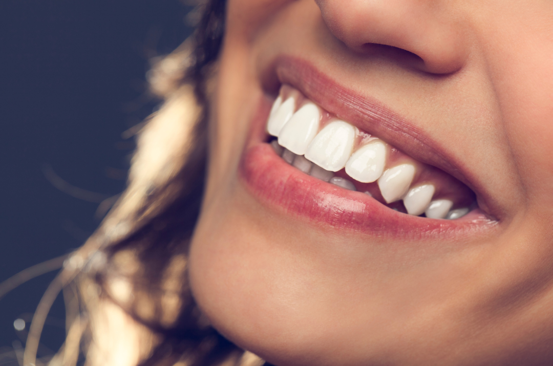 A importância da estética dos dentes para um sorriso bonito - boca