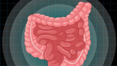 Câncer de intestino: a detecção precoce é fundamental para o tratamento e a cura