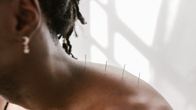 Os benefícios da acupuntura na saúde e no bem-estar