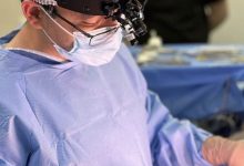Lipo HD: cirurgião plástico aponta três razões para evitá-la
